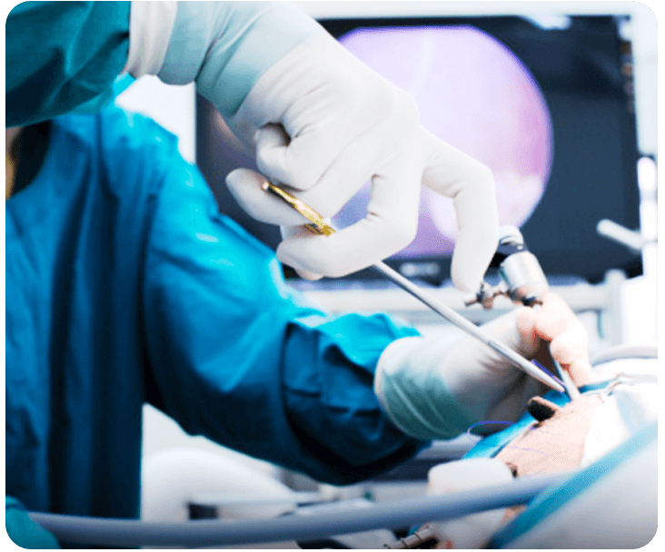 Cirugía de la hernia y eventración por vía laparoscópica